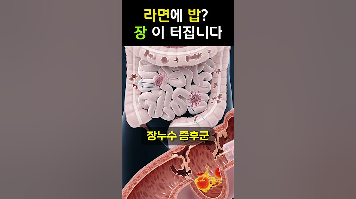 라면에 밥 말아먹는 습관. 장이 터집니다.