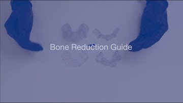 Bone Reduction Guide