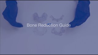 Bone Reduction Guide