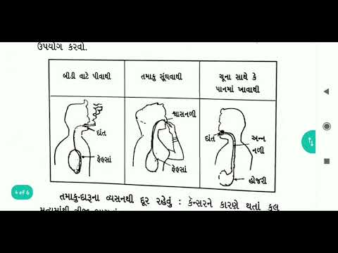 કેન્સરની નવી આશ -આધુનિક સારવાર