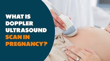 What is Doppler Ultrasound scan in  Pregnancy? #pregancy #pregnancyscan #doppler #ultrasoundscan