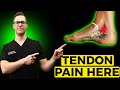 Posterior Tibial Tendonitis Treatment [Inside of the Ankle Pain] 2021!