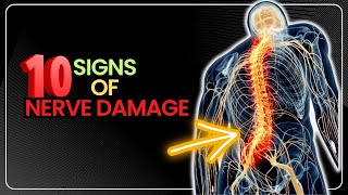 10 Symptoms and Signs of Nerve Damage You Should Never Ignore