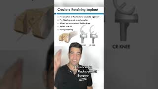 Advances in Knee Replacement Surgery