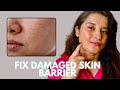 Signs your skin barrier is damaged and how to fix it ft Kass Skincare