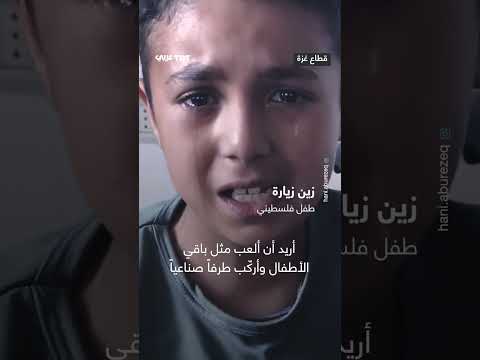 طفل فلسطيني فقد قدمه بسبب قصف جيش الاحتلال الإسرائيلي في بداية حرب الإبادة على غزة