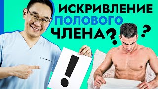 Искривление полового члена (болезнь Пейрони). Как вылечить кривой член?