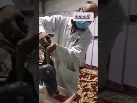 طريقة ترك التدخين علاج الربو علاج التحسس