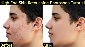High-End Skin Retouching with Just 2 Layers! - Photoshop Tutorial