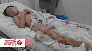 Cứu sống bé trai 8 tuổi ngã vào hố tro | VTC