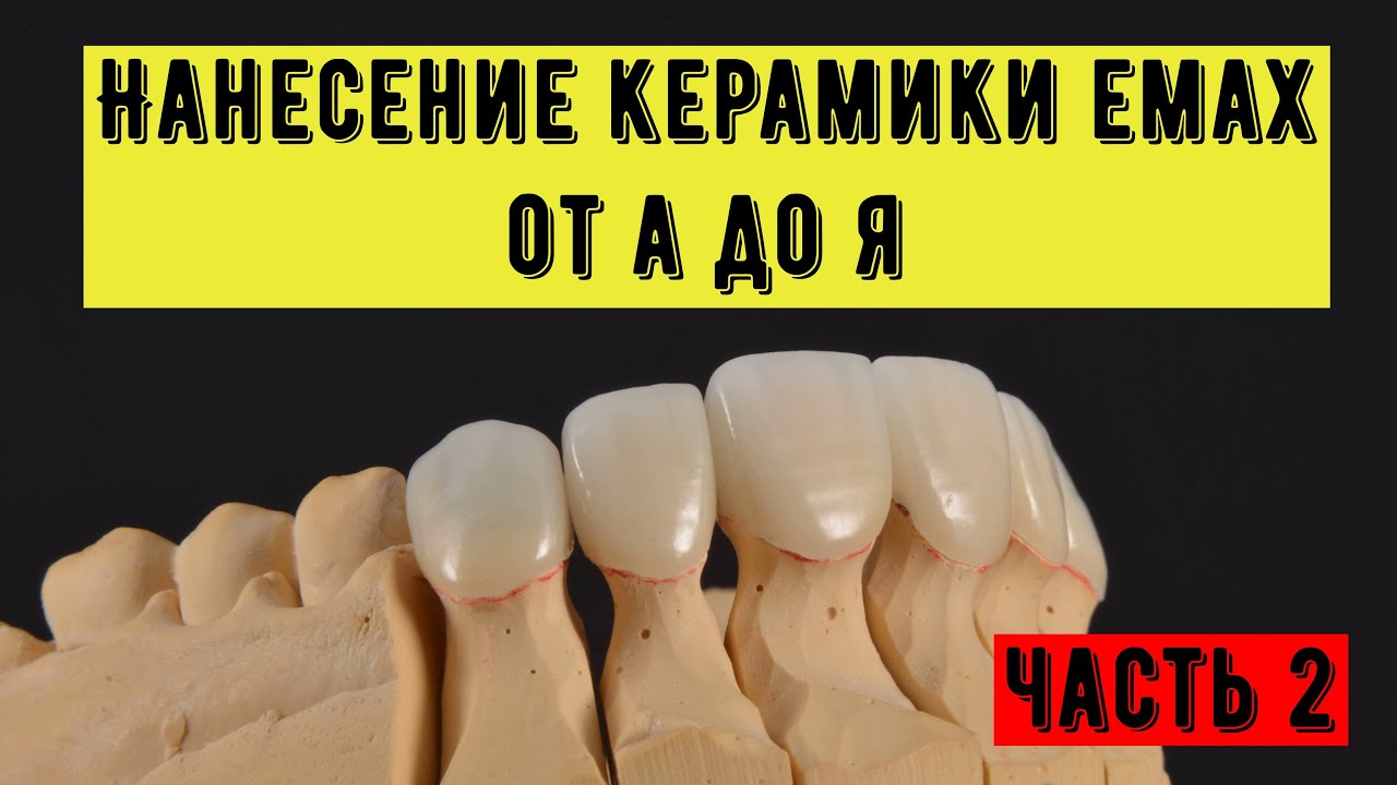 Нанесение керамики emax на диоксид циркония каркас. Нанесение из 6 масс ...
