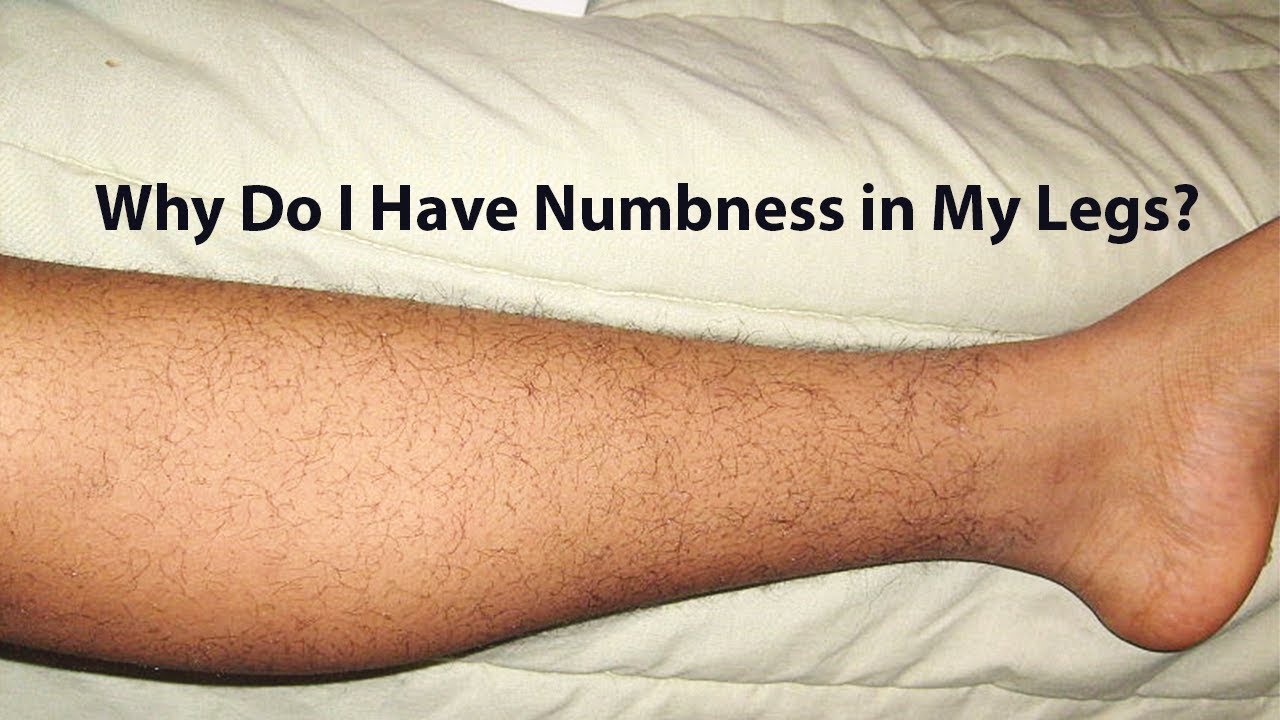 Why Do I Have Numbness in My Legs? - YouTube