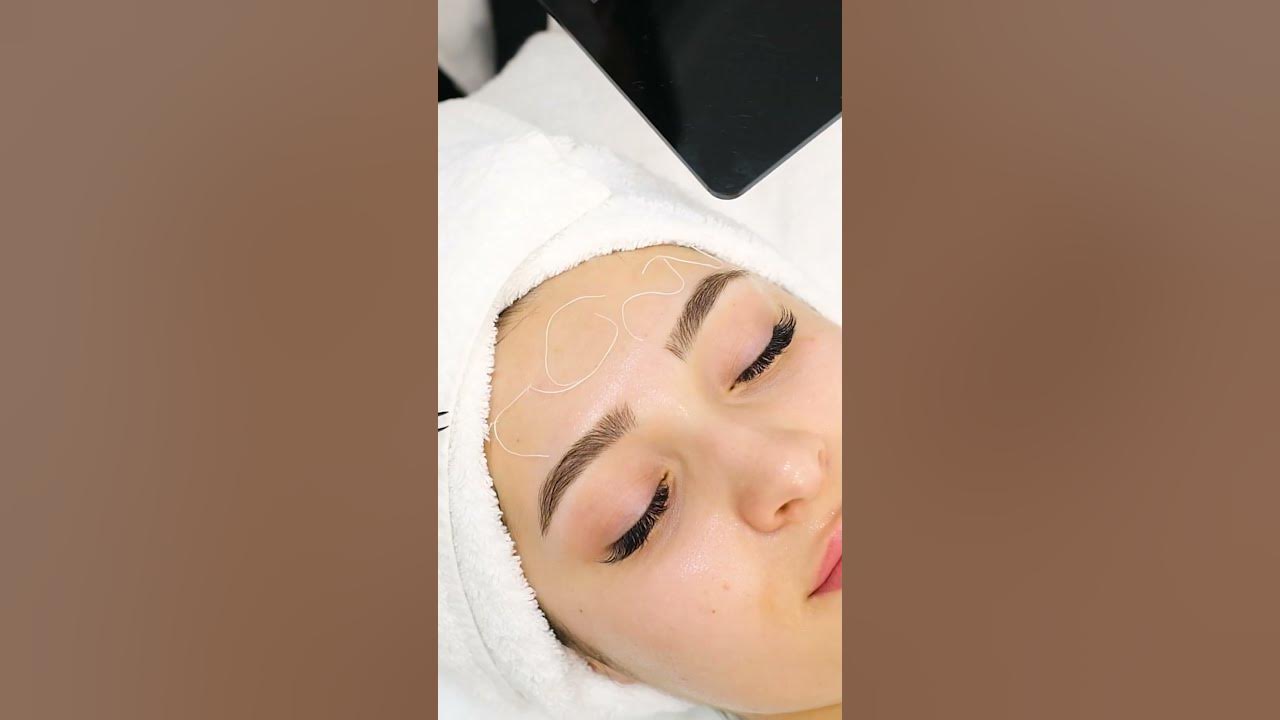 Козметични конци за заличаване на бръчки - YouTube