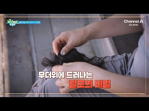 [예고] <strong>부분가발</strong> 없이는 외출도 두렵다?! 여름철 탈모 고민의 건강한 해결책은? | 건강 스페셜 한양촌 101 회