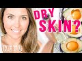 DRY SKIN From The Keto Diet?, Watch This!