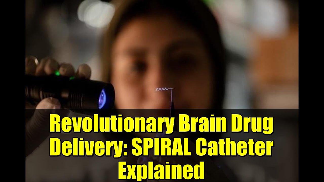 Revolutionary Brain Drug Delivery: SPIRAL Catheter Explained
