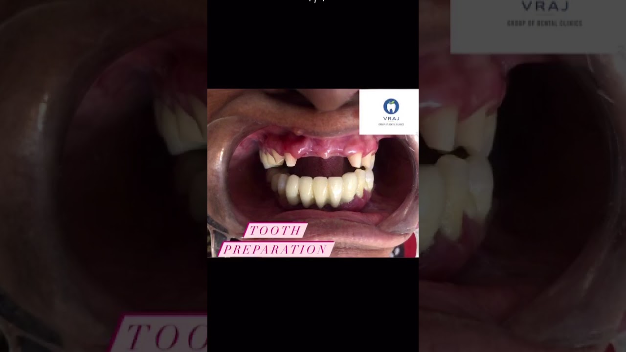 TRANSFORMATION AT VRAJ GROUP OF DENTAL CLINICS.