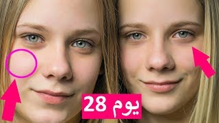 سر جمال الوجه بدون عمليات تجميل | أسهل وصفة في العالم لتبييض الوجه وتصفية البشرة #للجنسين