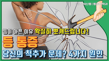 등통증 원인!  당신의 척추가 문제? 4가지 원인 (AKA 흉추기인성 등 통증)