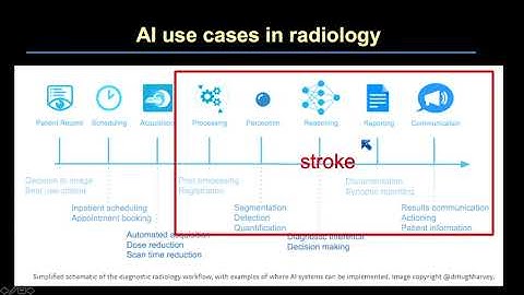 Artificial Intelligence for Acute Stroke Imaging by Kambiz Nael, M.D.