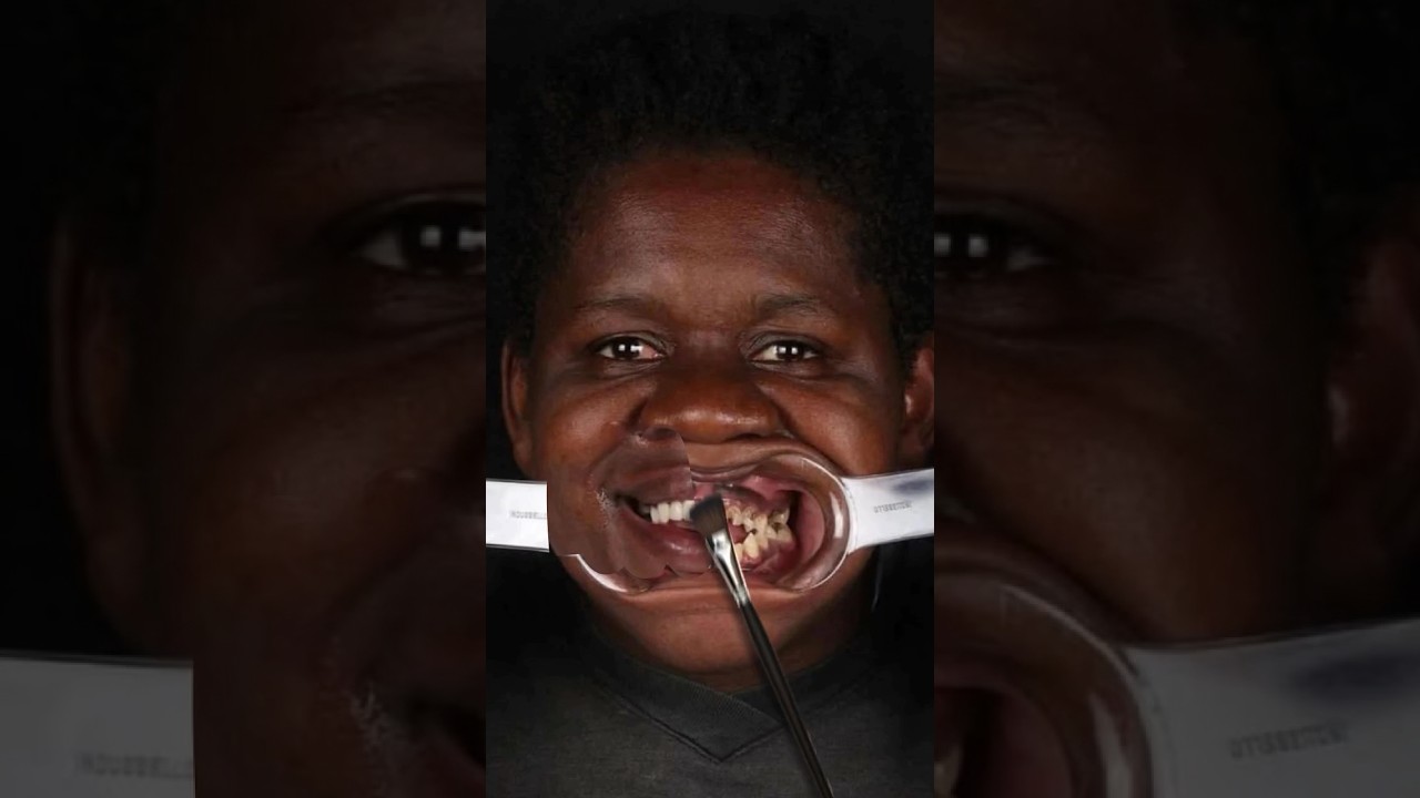 Dental Photography Motion Design 🔥 Dentiphoto Application #dentalphotography #smile #dentalartistry