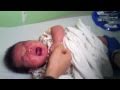 Newborn baby 2 month vaccination