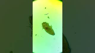 I found one of the worlds smallest animal in my backyard! - microscope