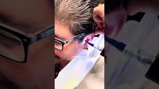 ear earwaxremoval earcleaning wax cerumen relax earwax satisfyingvideo musicmonth doctorae