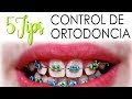 APROVECHA AL MÁXIMO TUS CONSULTAS DE ORTODONCIA | 5 TIPS