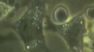 Гибель раковой клетки Гибель раковой клетки