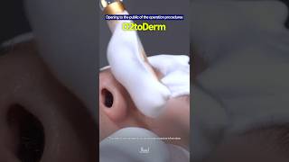 Disclosure The Procedure Process Of O2Toderm