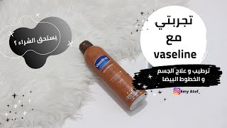 تجربتي مع اسبراي vaseline للجسم هل يستحق الشراء ؟؟