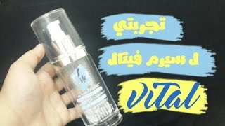 تجربتي ل سيرم فيتال/vital serum/قناة بنوتة صعيدية