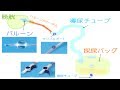 看護学生講座 269 腎 ｢バルーンカテーテルのしくみと国試ポイント(持続的導尿)」