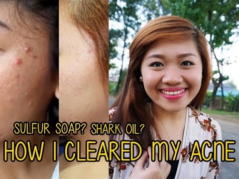 skinmate facial toner