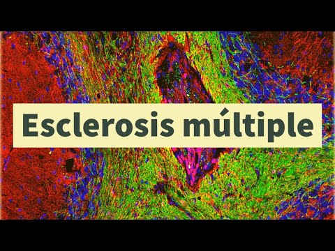 Vídeo: Tratamientos Primarios Progresivos De Esclerosis Múltiple