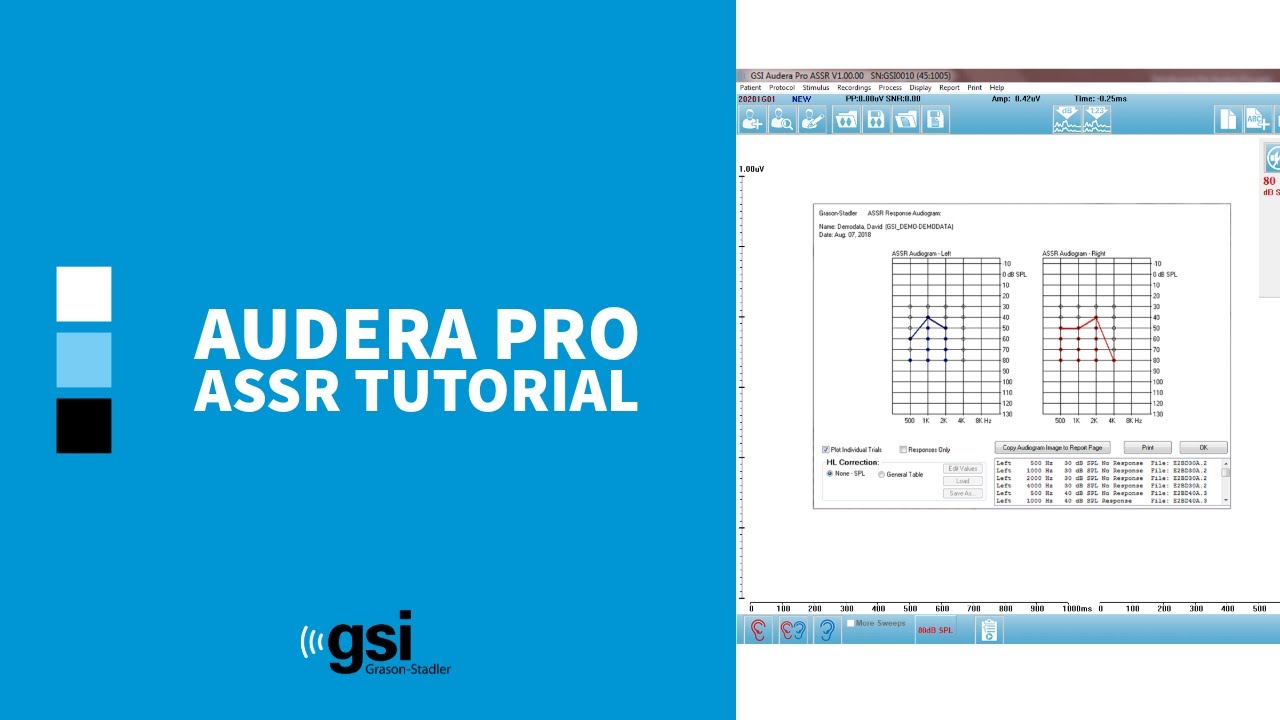Audera Pro: ASSR Tutorial