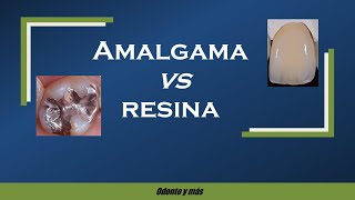 AMALGAMA O RESINA? Cuál es mejor?