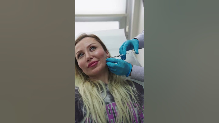 No More Teeth Grinding!  #masseterbotoks #Botox #Shorts