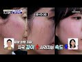 노화가 피부 탄력에 미치는 영향력과 주름을 유발하는 원인💥 TV CHOSUN 240504 방송 | [손범수와 함께 100세 더하기] 8회 | TV조선