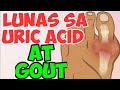 Lunas sa Mataas ang Uric Acid at Gout - Payo ni Doc Willie Ong #57b