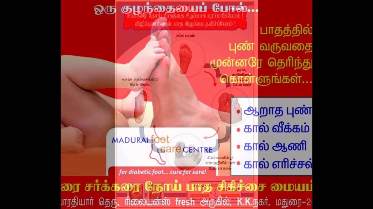 Madurai Foot Care Centre, Madurai, Tamilnadu, India. YouTube