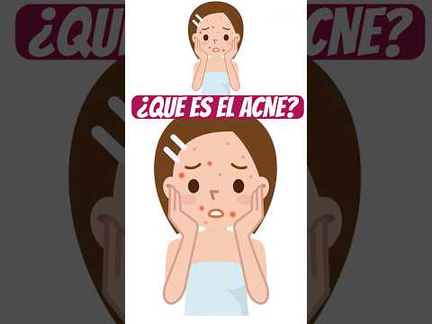 ✨¿Qué es el acné? #piel #curiosidades #sabiasque