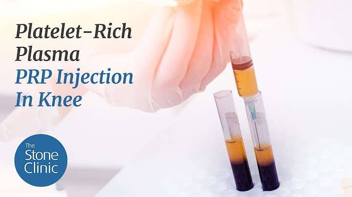 Platelet rich plasma therapy reviews ppt