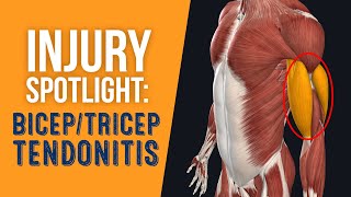 Injury Spotlight: Bicep & Tricep Tendonitis