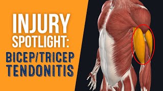 Injury Spotlight Bicep & Tricep Tendonitis