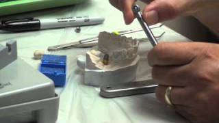 Implant Crown Delivery Part 3