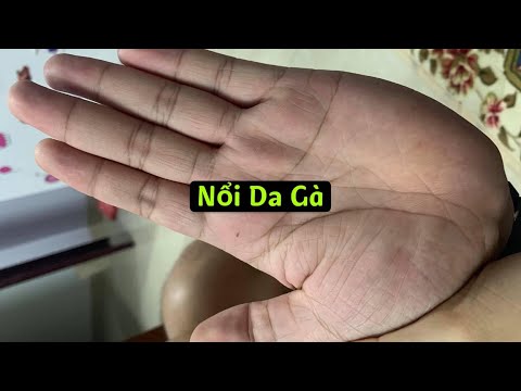 Nổi Hết Da Gà Khi Xem Bàn Tay NÀY (Zalo:0766623979) | Foci