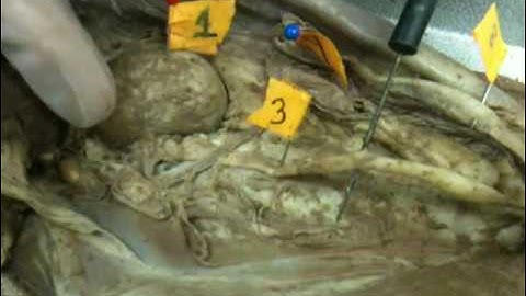 WLU Cat Dissection (Organs, Part 3)