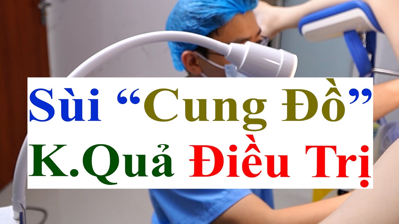 Sùi Mào Gà Rất Nặng Sâu Trong Cung Đồ | Kết Quả Trước & Sau Điều Trị Bằng Đốt Điện Tại PK Bs Sắc